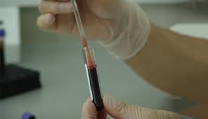 Endocrine Testing Market Size & Pricing Overview