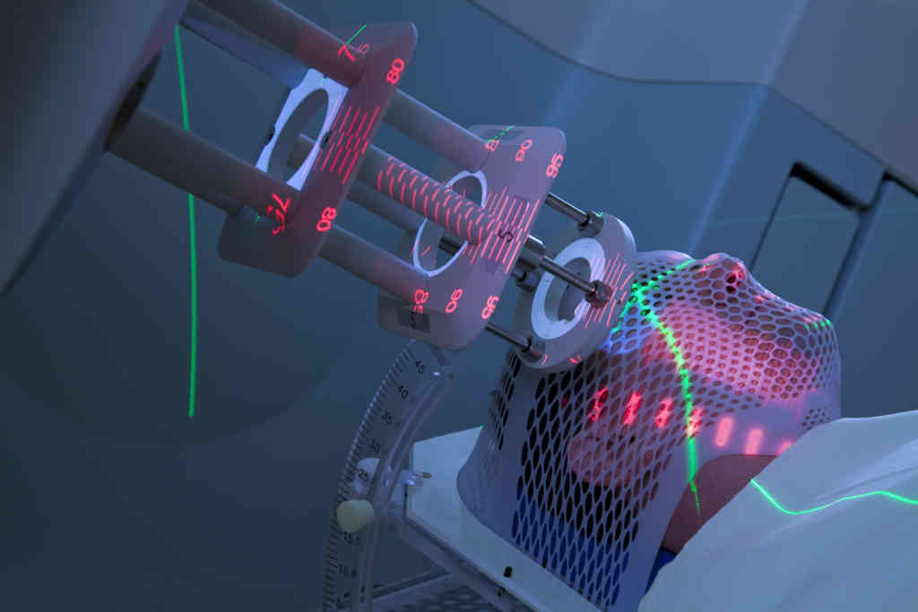 Medical Laser Systems Market Industry Growth & Forecast 2033