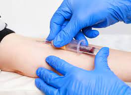 Blood Collection Market Size, Share | Forecast